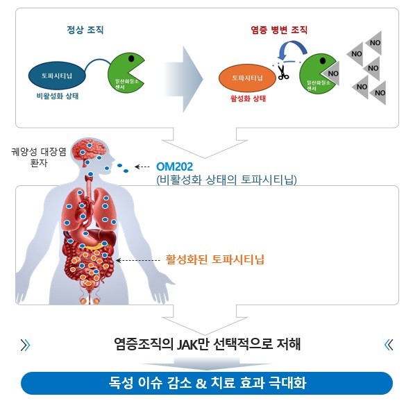 K-MEDI hub, 궤양성 대장염 치료제 원스톱 개발 지원 - 뉴스 썸네일 이미지