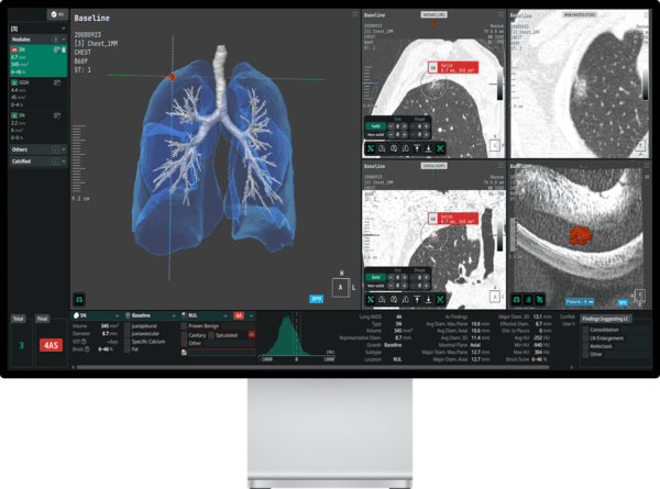 코어라인소프트 '에이뷰 LCS 플러스' 제품. 제공=코어라인소프트&nbsp;